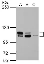 Anti-MTBP antibody [N1N3] used in Western Blot (WB). GTX115837