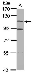 Anti-MTBP antibody [C2C3], C-term used in Western Blot (WB). GTX115838