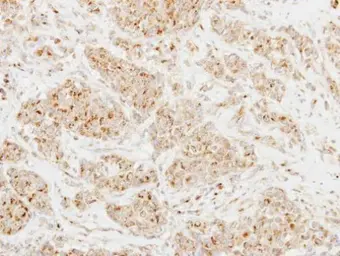 Anti-CLUL1 antibody [N3C3] used in IHC (Paraffin sections) (IHC-P). GTX115840