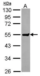 Anti-CLUL1 antibody [N3C3] used in Western Blot (WB). GTX115840