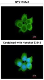 Anti-CacyBP antibody [N1C3] used in Immunocytochemistry/ Immunofluorescence (ICC/IF). GTX115841