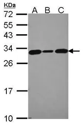 Anti-CacyBP antibody [N1C3] used in Western Blot (WB). GTX115841