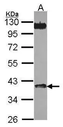 Anti-CHIA antibody used in Western Blot (WB). GTX115847