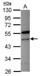 Anti-VPS4A antibody [N1C1] used in Western Blot (WB). GTX115853
