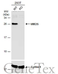 Anti-UBE2S antibody [N1C2] used in Western Blot (WB). GTX115862