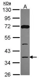 Anti-DCPS antibody [N3C3] used in Western Blot (WB). GTX115870