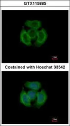 Anti-Tropomodulin 3 antibody used in Immunocytochemistry/ Immunofluorescence (ICC/IF). GTX115885