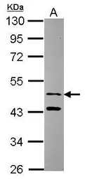 Anti-SNX15 antibody used in Western Blot (WB). GTX115896