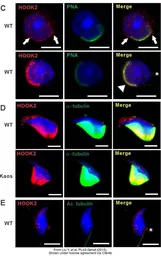Anti-HOOK2 antibody used in Immunocytochemistry/ Immunofluorescence (ICC/IF). GTX115898
