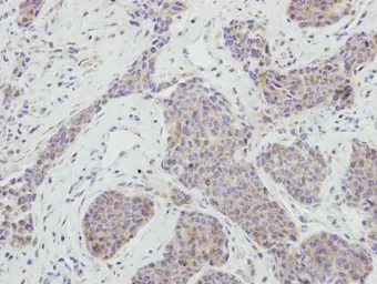Anti-NRBP1 antibody [N1C1] used in IHC (Paraffin sections) (IHC-P). GTX115907