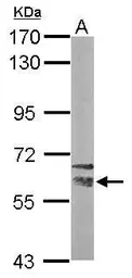 Anti-NRBP1 antibody [N1C1] used in Western Blot (WB). GTX115907