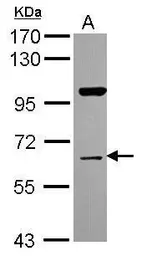 Anti-NRBP1 antibody [N1C1] used in Western Blot (WB). GTX115907