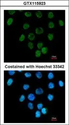 Anti-CARP antibody [N3C3] used in Immunocytochemistry/ Immunofluorescence (ICC/IF). GTX115923