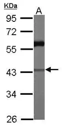 Anti-CARP antibody [N3C3] used in Western Blot (WB). GTX115923