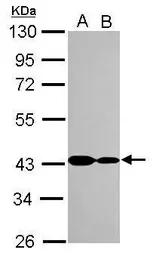 Anti-CARP antibody [N3C3] used in Western Blot (WB). GTX115923