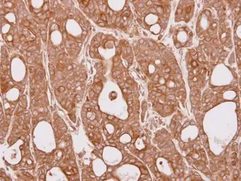 Anti-CEP57 antibody [N1C1] used in IHC (Paraffin sections) (IHC-P). GTX115931
