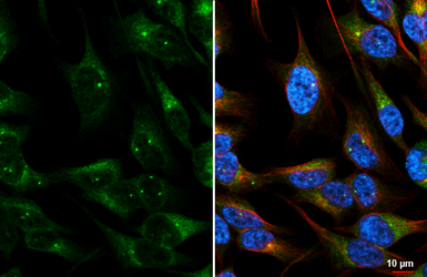Anti-CEP57 antibody [N1C1] used in Immunocytochemistry/ Immunofluorescence (ICC/IF). GTX115931