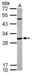 Anti-ANP32A antibody [N1C2] used in Western Blot (WB). GTX115933