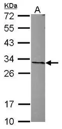 Anti-ANP32A antibody [N1C2] used in Western Blot (WB). GTX115933
