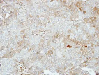 Anti-VPS28 antibody used in IHC (Paraffin sections) (IHC-P). GTX115937