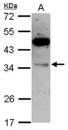 Anti-VPS28 antibody used in Western Blot (WB). GTX115937