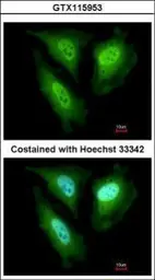 Anti-FBL4 antibody [N1C1] used in Immunocytochemistry/ Immunofluorescence (ICC/IF). GTX115953