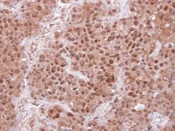 Anti-FBL4 antibody [N1C1] used in IHC (Paraffin sections) (IHC-P). GTX115953