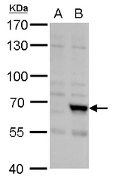 Anti-FBL4 antibody [N1C1] used in Western Blot (WB). GTX115953