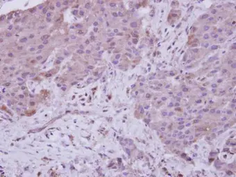 Anti-NARG1 antibody [C2C3], C-term used in IHC (Paraffin sections) (IHC-P). GTX115958
