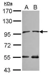 Anti-NARG1 antibody [C2C3], C-term used in Western Blot (WB). GTX115958