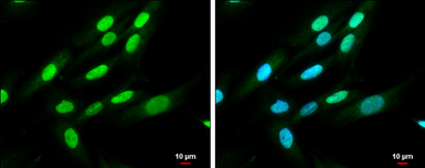 Anti-QKI antibody [N2C3] used in Immunocytochemistry/ Immunofluorescence (ICC/IF). GTX115969