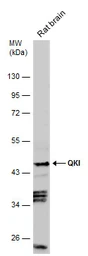 Anti-QKI antibody [N2C3] used in Western Blot (WB). GTX115969