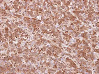 Anti-QKI antibody [N2C3] used in IHC (Paraffin sections) (IHC-P). GTX115969