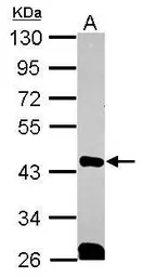 Anti-QKI antibody [N2C3] used in Western Blot (WB). GTX115969