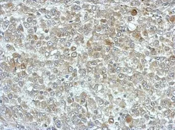 Anti-PPME1 antibody used in IHC (Paraffin sections) (IHC-P). GTX115970