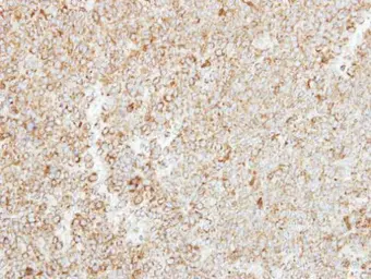 Anti-MTHFS antibody [N1C3] used in IHC (Paraffin sections) (IHC-P). GTX115971