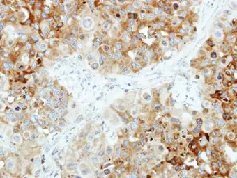 Anti-B4GALT4 antibody [N2C3] used in IHC (Paraffin sections) (IHC-P). GTX115980
