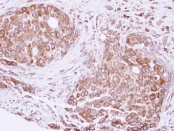 Anti-ATE1 antibody [C1C3] used in IHC (Paraffin sections) (IHC-P). GTX115990