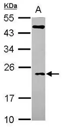 Anti-TC10 antibody [N1C3] used in Western Blot (WB). GTX115991
