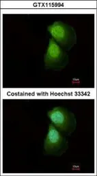 Anti-PRMT5 antibody [N1N3] used in Immunocytochemistry/ Immunofluorescence (ICC/IF). GTX115994