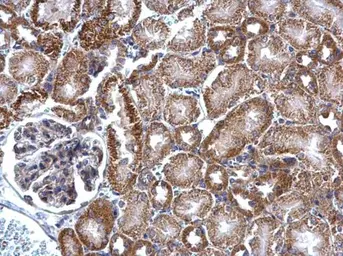 Anti-PRMT5 antibody [N1N3] used in IHC (Paraffin sections) (IHC-P). GTX115994