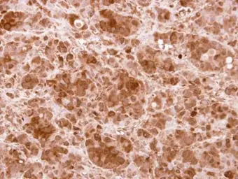 Anti-PRMT5 antibody [N1N3] used in IHC (Paraffin sections) (IHC-P). GTX115994