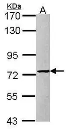 Anti-PRMT5 antibody [N1N3] used in Western Blot (WB). GTX115994