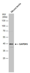 Anti-GAPDHS antibody used in Western Blot (WB). GTX116000