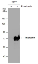 Anti-Involucrin antibody [N1N2], N-term used in Western Blot (WB). GTX116012