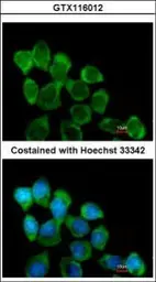 Anti-Involucrin antibody [N1N2], N-term used in Immunocytochemistry/ Immunofluorescence (ICC/IF). GTX116012