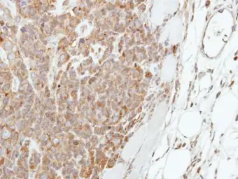 Anti-Involucrin antibody [N1N2], N-term used in IHC (Paraffin sections) (IHC-P). GTX116012