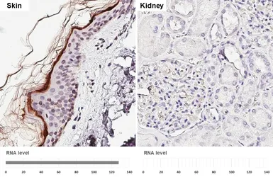 Anti-Loricrin antibody [N1], N-term used in IHC (Paraffin sections) (IHC-P). GTX116013