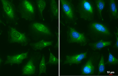 Anti-Presenilin 1 antibody [C1C2], Internal used in Immunocytochemistry/ Immunofluorescence (ICC/IF). GTX116016