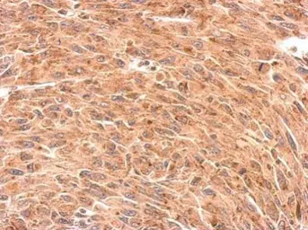 Anti-Presenilin 1 antibody [C1C2], Internal used in IHC (Paraffin sections) (IHC-P). GTX116016